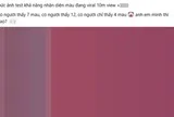 “Bức ảnh đếm màu đang viral với 10 triệu view”: Đáp án cuối cùng là gì?