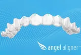 Phán Quyết của Tòa Án Paris về Tính Năng Đã Ngừng Cung Cấp Sẽ Ít Ảnh Hưởng đến Khách Hàng của Angelalign