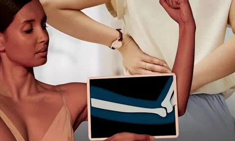 Phụ nữ bước qua tuổi 30 thường mắc 3 sai lầm khiến xương yếu đi và mỏng dần: 7 dưỡng chất bác sĩ khuyên nên biết sớm