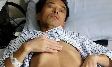 Người đàn ông mắc ung thư gan vì ngày nào cũng uống nước từ loại cốc nhiều người dùng mỗi ngày