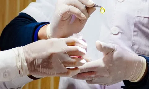 Biết mình không còn nhiều thời gian, cô gái 26 tuổi hiến giác mạc