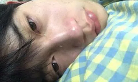 Bác sĩ nhắc nhở 6 triệu chứng phổ biến nhất của ung thư ruột: Tiếc là rất nhiều người bỏ qua, tưởng là… "ốm vặt"