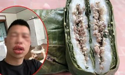 Tết Thanh Minh rủ nhau ăn bánh trứng kiến: Người khen “nổ bôm bốp vui miệng”, người thì… "đổi luôn giao diện" vì dị ứng