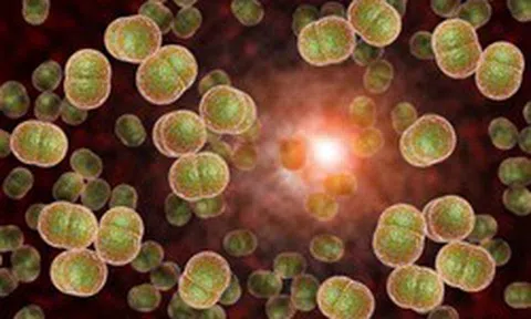 Vi khuẩn “ẩn mình” trong họng, có thể gây tử vong trong vòng 24 giờ