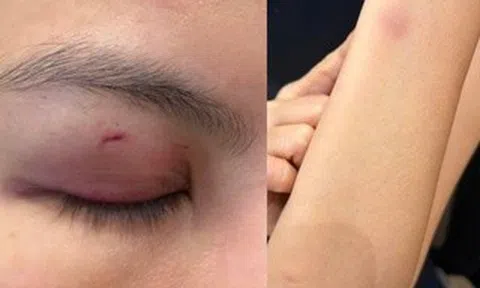 Công an phường Sài Gòn xác minh vụ ca sĩ Trung Quân Idol đánh phụ nữ