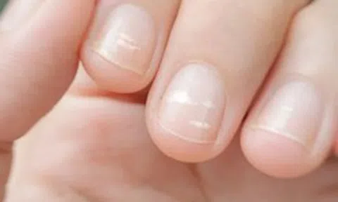Ung thư có thể được phát hiện qua bàn tay? Bác sĩ cảnh báo: Xuất hiệu 5 dấu hiệu này, đừng nên chủ quan