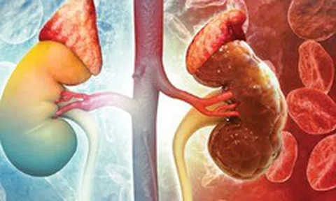 1 thói quen buổi tối có thể khiến thận xuống cấp nhanh chóng: Gặp ở rất nhiều người Việt