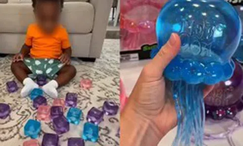 Cảnh báo về món đồ chơi hot Tiktok hàng triệu người đang mua: Con chỉ làm theo một video trên mạng, hậu quả là bỏng mặt và cánh tay