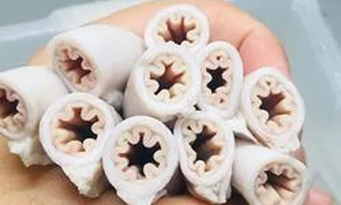 Bác sĩ tiết lộ sự thật về lòng se điếu: Ai ăn kiểu này dễ nhiễm ký sinh trùng