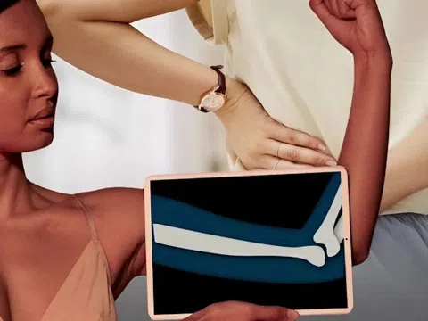 Phụ nữ bước qua tuổi 30 thường mắc 3 sai lầm khiến xương yếu đi và mỏng dần: 7 dưỡng chất bác sĩ khuyên nên biết sớm