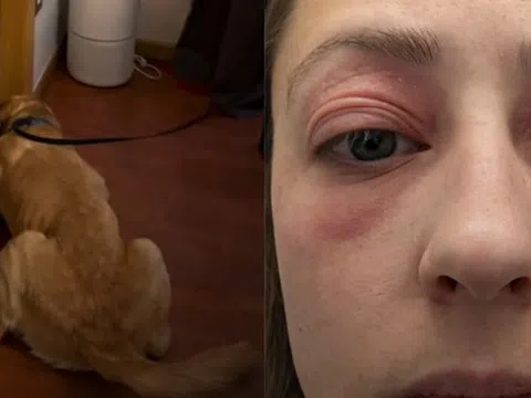 Bỏ 10 tỷ mua nhà, dọn vào ở được vài tháng, người phụ nữ mắc phải căn bệnh lạ khiến cơ thể biến dạng