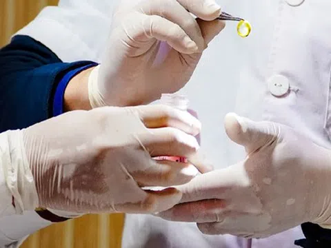 Biết mình không còn nhiều thời gian, cô gái 26 tuổi hiến giác mạc