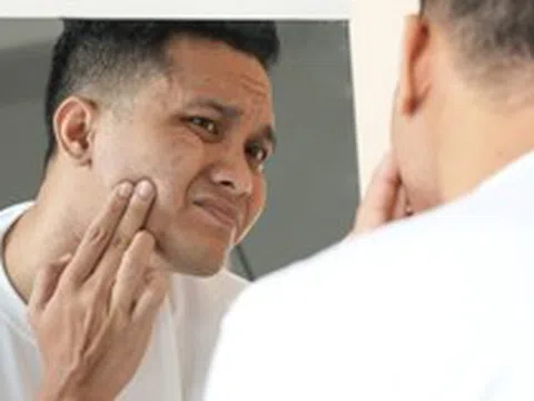 Triệu chứng ban đầu của bệnh tiểu đường có thể xuất hiện trên mặt: Thấy 7 dấu hiệu này, hãy đi khám ngay