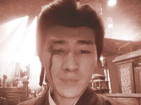 Diễn viên tố đoàn phim bỏ mặc sau tai nạn phải khâu 6 mũi