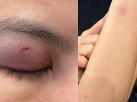 Luật sư nhận định vụ ca sĩ Trung Quân Idol bị tố đánh phụ nữ