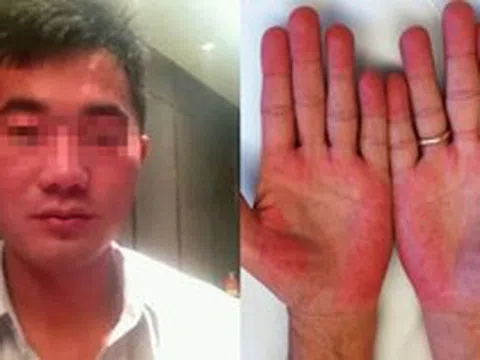 Người đàn ông không bia rượu nhưng ngày nào cũng bị kiểm tra nồng độ cồn, biết sự thật phía sau ai cũng xót xa