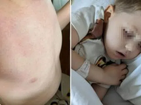 Nam shipper 38 tuổi bật khóc: "Bác sĩ nói vết ngứa trên da con tôi không đáng lo, 3 tuần sau lại bảo là ung thư"