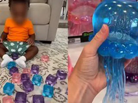 Cảnh báo về món đồ chơi hot Tiktok hàng triệu người đang mua: Con chỉ làm theo một video trên mạng, hậu quả là bỏng mặt và cánh tay