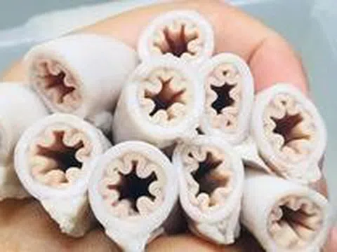 Bác sĩ tiết lộ sự thật về lòng se điếu: Ai ăn kiểu này dễ nhiễm ký sinh trùng